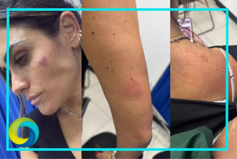 Agreden a alcaldesa Alessandra Rojo y personal de la Cuauhtémoc durante operativo