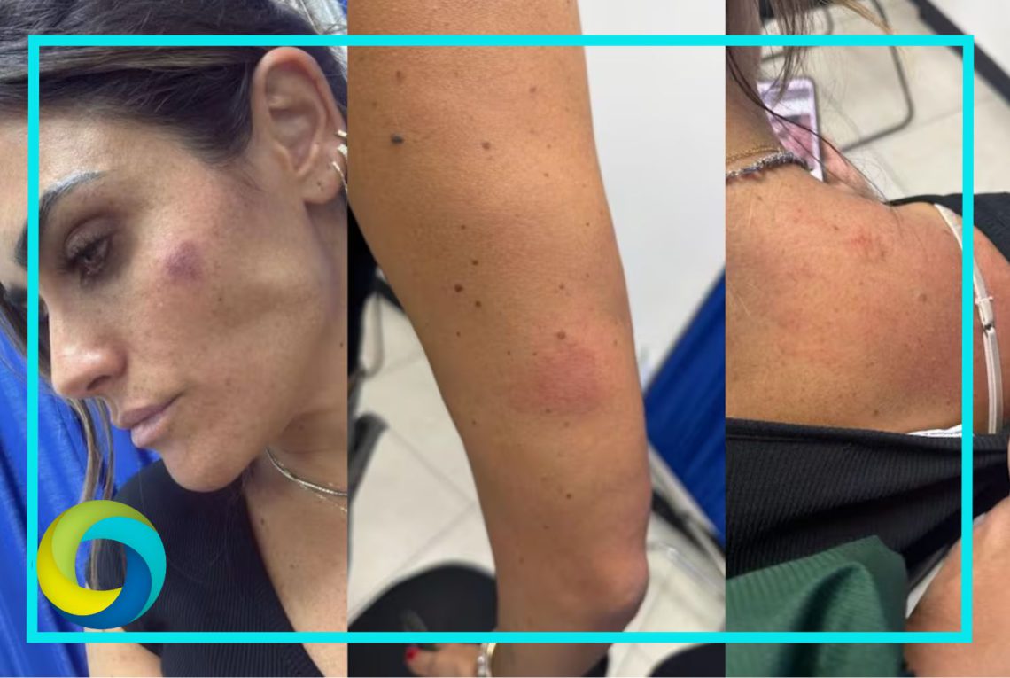Agreden a alcaldesa Alessandra Rojo y personal de la Cuauhtémoc durante operativo